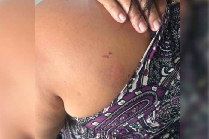mulher-e-agredida-pela-namorada-apos-surto-de-ciumes-em-rio-verde