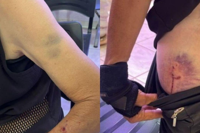 mulher-se-recusa-a-ir-para-cama-e-e-abusada-pelo-companheiro-em-rio-verde